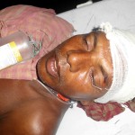 Victim of TMC attack