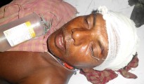 Victim of TMC attack