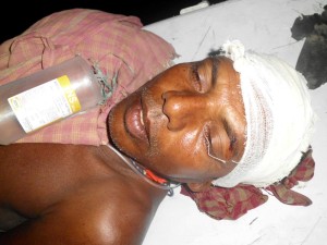 Victim of TMC attack